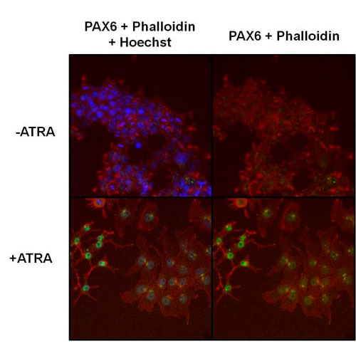 29517. PAX6 ANTIBODY-STEM CELL MARKER 100UG ABCAM