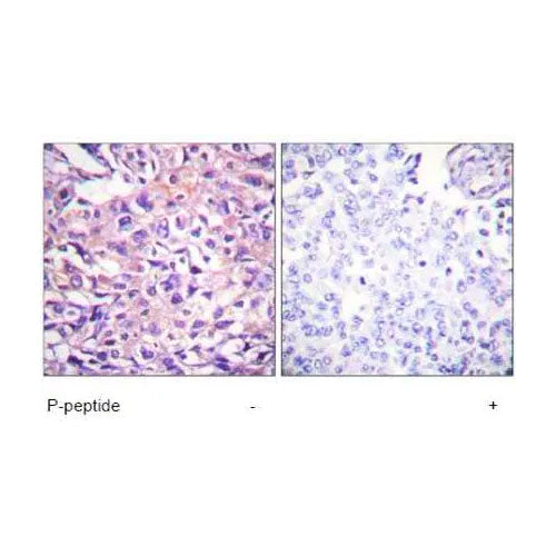 29182. ANTI-MYOSIN PHOSPHATASE (PHOSPHO T696) ANTIBODY 100UG ABCAM