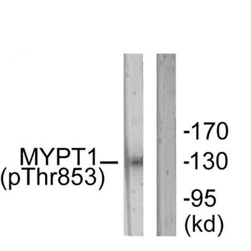 23900. ANTI-MYOSIN PHOSPHATASE (PHOSPHO T853) ANTIBODY 100UG ABCAM