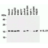 27953. ANTI-IL-21 ANTIBODY 100UG ABCAM