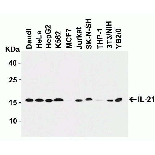 27953. ANTI-IL-21 ANTIBODY 100UG ABCAM