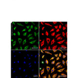 23901. ANTI-BETA TUBULIN ANTIBODY-LOADING CONTROL 100UG ABCAM