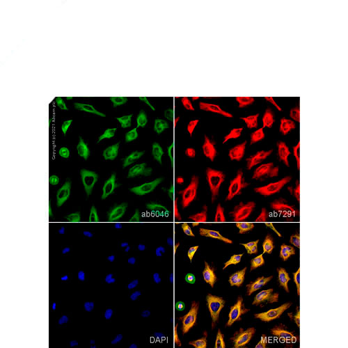 23901. ANTI-BETA TUBULIN ANTIBODY-LOADING CONTROL 100UG ABCAM
