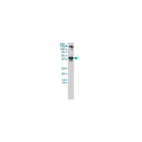 29519. ANTI-NEUROD1 ANTIBODY (3H8)-BSA AND AZIDE FREE 100UG ABCAM