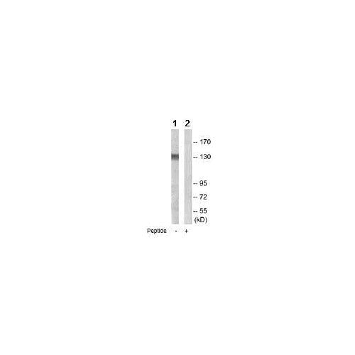 27959. ANTI-AC5 ANTIBODY 100UG ABCAM