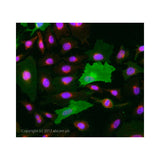 29895. ANTI-CD105 ANTIBODY (MEM-229) 100UG ABCAM