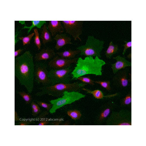 29895. ANTI-CD105 ANTIBODY (MEM-229) 100UG ABCAM