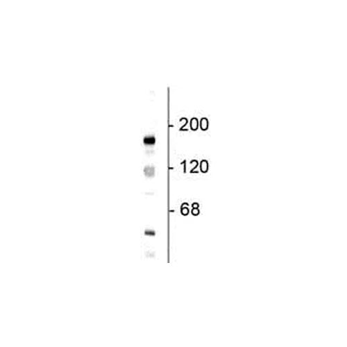 27962. ANTI-NMDAR2B ANTIBODY 100UL ABCAM