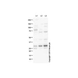 29524. ANTI-MASH1/ACHAETE-ACUTE HOMOLOG 1 ANTIBODY 100UG ABCAM