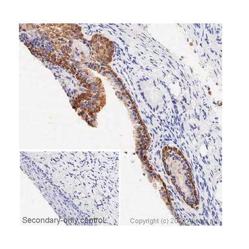 29233. RECOMBINANT ANTI-CYTOKERATIN 5 ANTIBODY (EPR1600Y) 100UL ABCAM