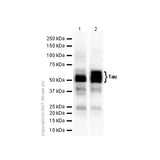 29525. RECOMBINANT ANTI-TAU ANTIBODY (EP2456Y) 100UL ABCAM