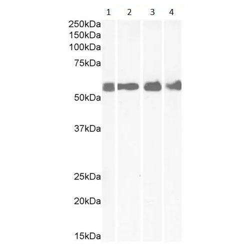 29526. ANTI-CRF1/CRHR1 ANTIBODY 200UL ABCAM