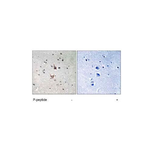 28814. ANTI-PRESENILIN 1/PS-1 (PHOSPHO S357) ANTIBODY 100UG ABCAM