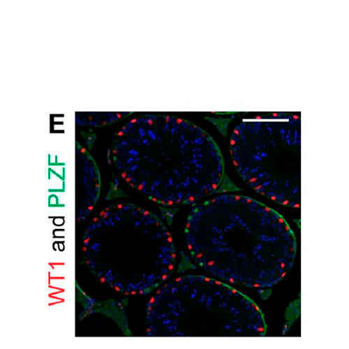 23914. RECOMBINANT ANTI-WILMS TUMOR PROTEIN ANTIBODY (CAN-R9(IHC)-56-2) 100UL ABCAM