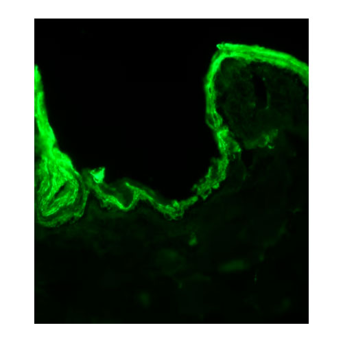 29852. ANTI-CYTOKERATIN 10 ANTIBODY (DE-K10) CYTOSKELETON MARKER 100UG ABCAM