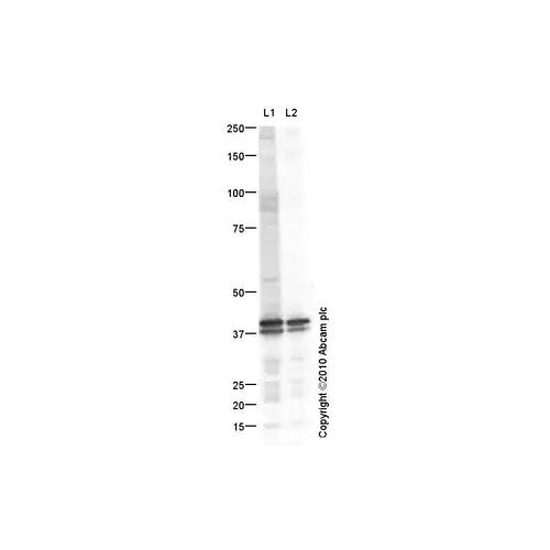 28819. ANTI-LIVER ARGINASE ANTIBODY 100UG