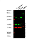 23915. RECOMBINANT ANTI-MLH1 ANTIBODY (EPR3894) 100UL ABCAM