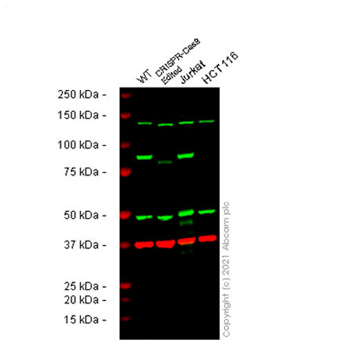 23915. RECOMBINANT ANTI-MLH1 ANTIBODY (EPR3894) 100UL ABCAM