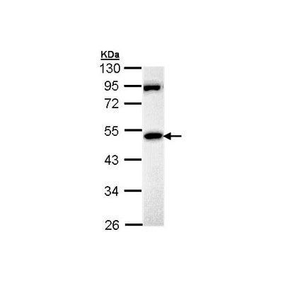 29862. ANTI-MPP1 ANTIBODY 50UL ABCAM