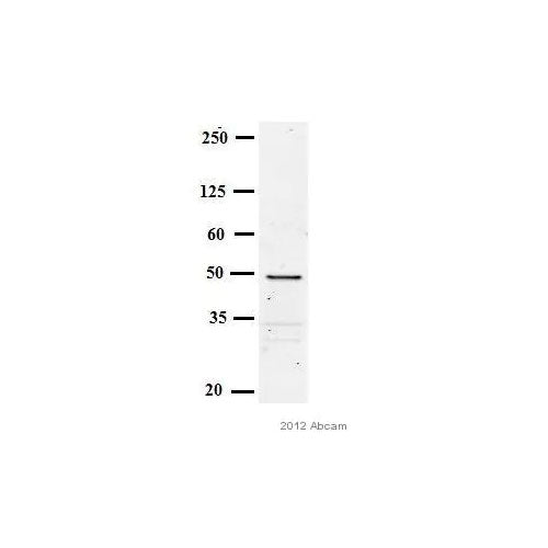 29885. GOAT ANTI-MOUSE IGG H&L HRP 1MG ABCAM