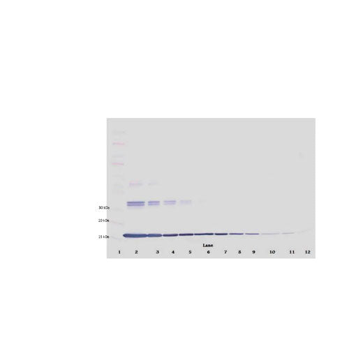 29533. ANTI-TNF ALPHA ANTIBODY 100UG ABCAM