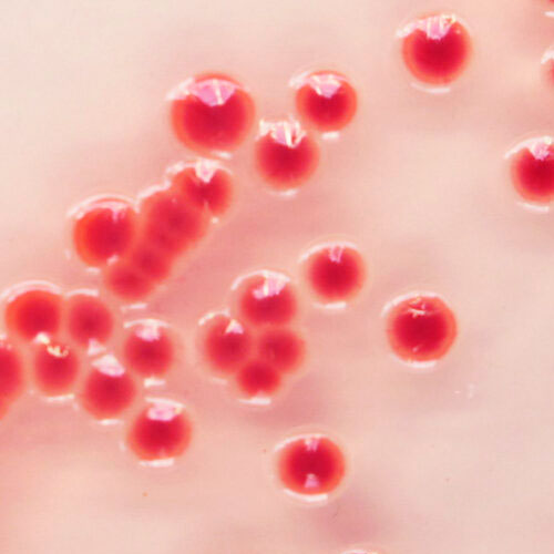 29694. ACINETOBACTER BASE 5000ML CHROMAGAR
