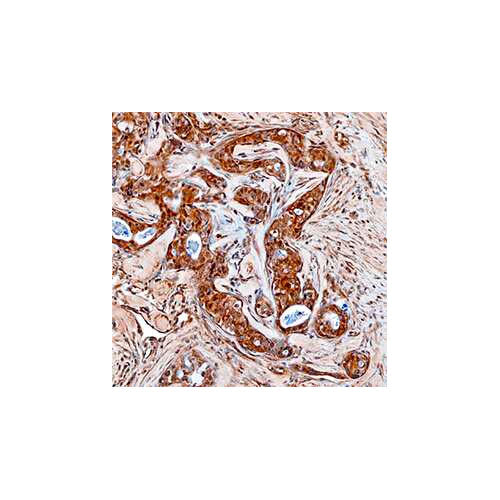 29014. HUMAN MMP-16/MT3-MMP ANTIBODY 100UG R&D SYSTEMS