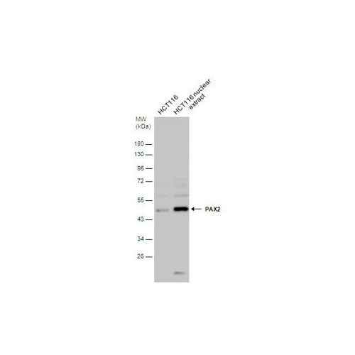 51163. HUMAN PAX2 ANTIBODY 100UG - R&D SYSTEMS