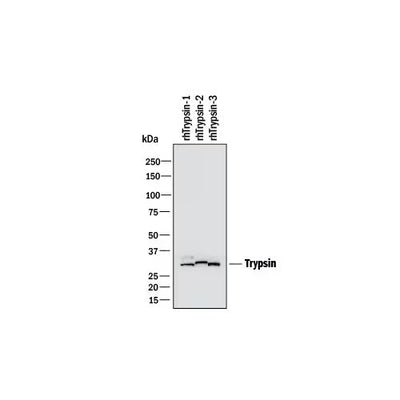 51176. HUMAN TRYPSIN PAN SPECIFIC (PRSS1/2/3) ANTIBODY 100UG - R&D SYSTEMS