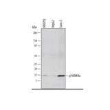 30014. HUMAN P16INK4A/CDKN2A ANTIBODY 100UG R&D SYSTEMS