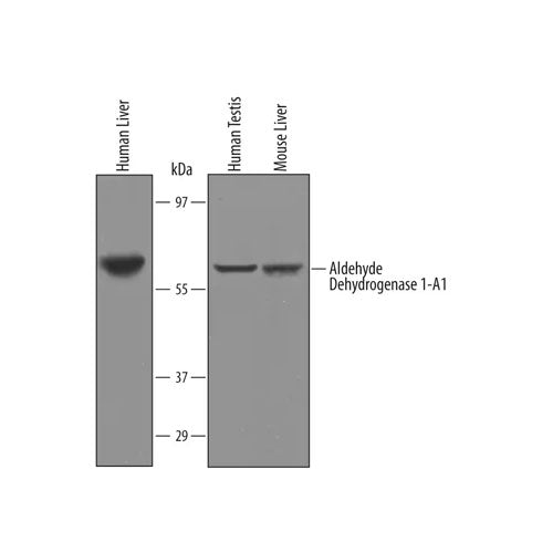 30020. HUMAN/MOUSE ALDEHYDE DEHYDROGENASE 1‑A1/ALDH1A1 ANTIBODY 25UG R&D SYSTEMS