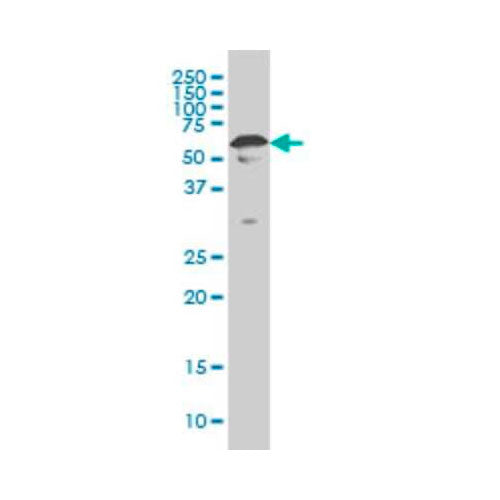 29994. YY1 ANTIBODY (4A5) 0.1MG NOVUS BIOLOGICALS