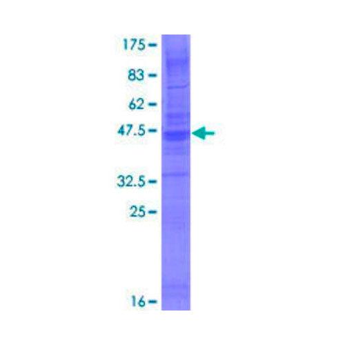 55953. RECOMBINANT HUMAN CMTM6 GST (N-TERM) PROTEIN 25UG NOVUS BIOLOGICALS