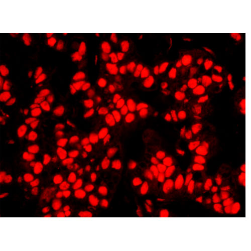 28433. RABBIT ANTI-NPM1 IHC ANTIBODY AFFINITY PURIFIED 10UG BETHYL LABS