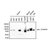 31056. BETA CATENIN MONOCLONAL ANTIBODY (15B8) 100UG INVITROGEN