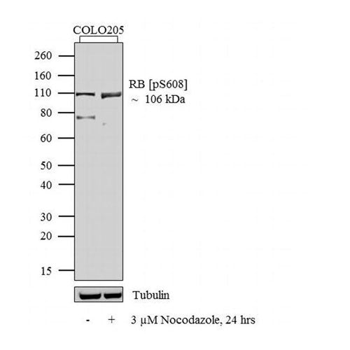 51198. ANTI-RETINOBLASTOMA (PHOSPHO- SERINE608) - THERMO SCIENTIFIC