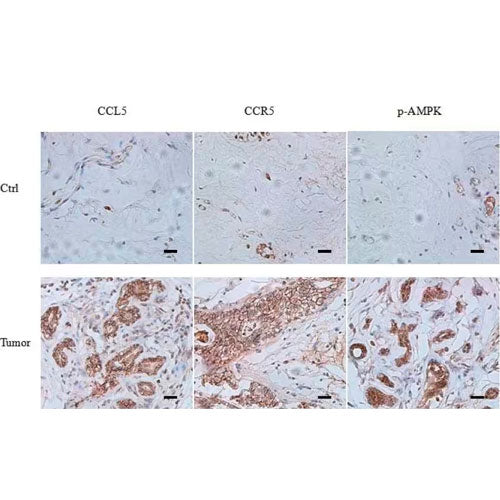 51165. HUMAN CCR5 ANTIBODY 100UG - R&D SYSTEMS