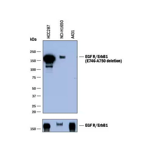 51813. HUMAN EGF R/ERBB1 (AA 746-750 DELETION) ANTIBODY 100UG - R&D SYSTEMS