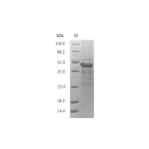 28131. AIIM RECOMBINANT PROTEIN (E-COLI) 0.02MG MY BIOSOURCE
