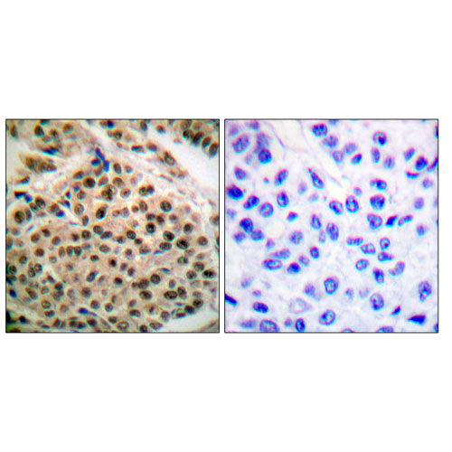 28153. ANTI-NFKB1 ANTIBODY 0.1MG MY BIOSOURCE