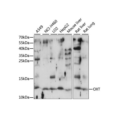 28132. ANTI-OXT ANTIBODY 0.2ML MY BIOSOURCE