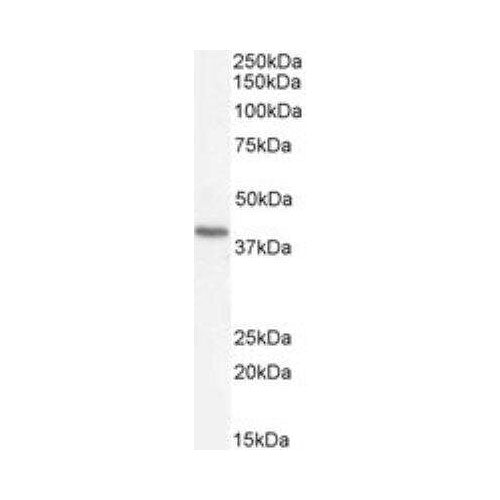 29992. RENIN R ANTIBODY 0.1MG NOVUS BIOLOGICALS