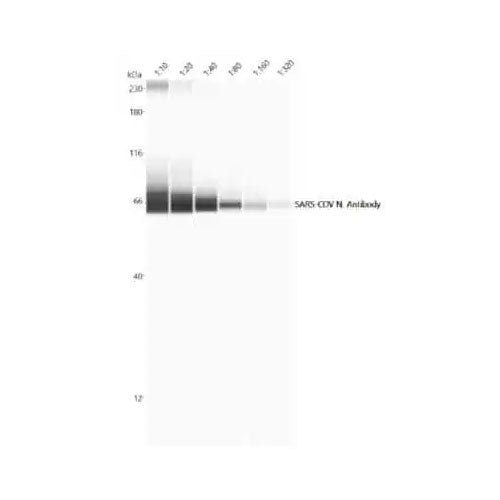 28835. SARS NUCLEOCAPSID PROTEIN ANTIBODY 0.1MG NOVUS BIOLOGICALS