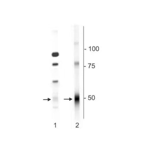 29553. ANTIBODY ANTI-GABA A RECEPTOR DELTA 0.1ML NOVUS BIOLOGICALS