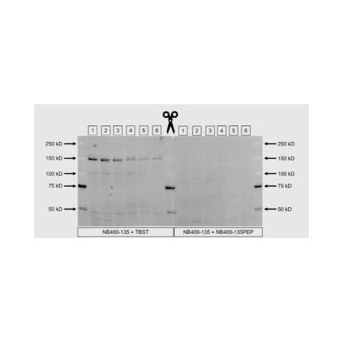 29539. CHREBP ANTIBODY-BSA FREE 0.1ML NOVUS BIOLOGICALS