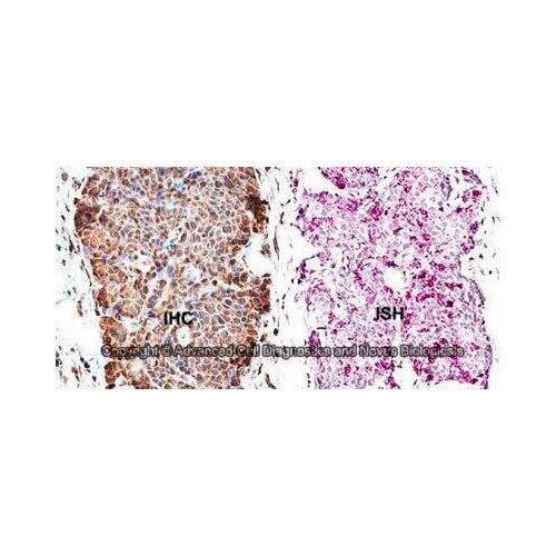 28194. SURVIVIN ANTIBODY-BSA FREE 0.025ML NOVUS BIOLOGICALS
