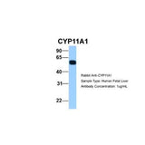 51170. RABBIT POLYCLONAL CYP11A1 ANTIBODY, 100UL, - NOVUS BIOLOGICALS