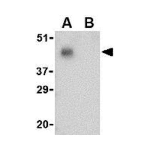 28189. PD-1 ANTIBODY-BSA FREE 0.1MG NOVUS BIOLOGICALS