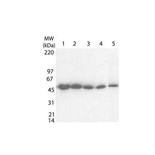 28165. CLOSTRIDIUM TETANI TOXOID ANTIBODY 0.1ML NOVUS BIOLOGICALS