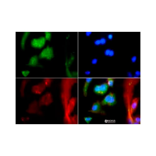 28187. MAS ANTIBODY-BSA FREE 0.1ML NOVUS BIOLGICALS